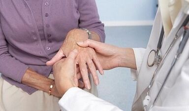 The doctor examines the joints of the hands suffering from arthritis and arthritis