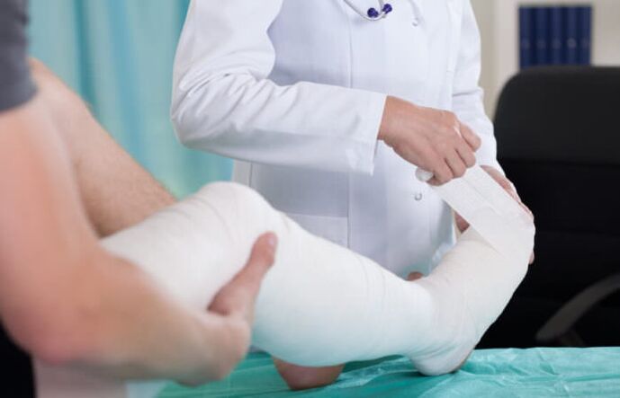 Plaster casts for knee pain