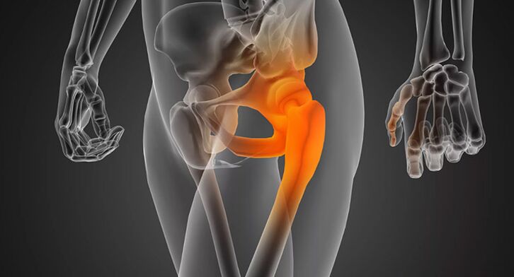 Infectious hip pain requires antibiotic treatment