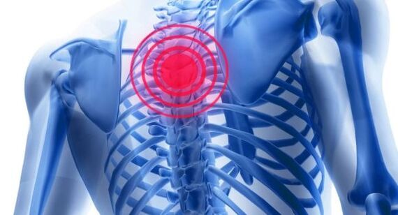 Treatment of thoracic vertebrae