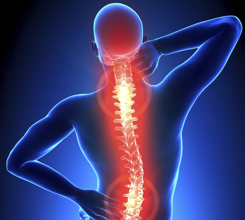 Osteochondral disease of the spine