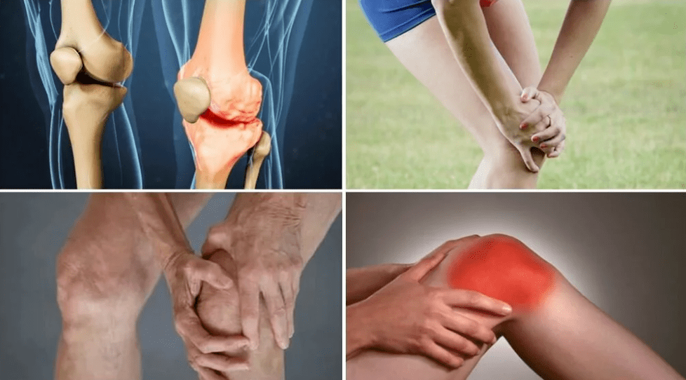 Joint symptoms