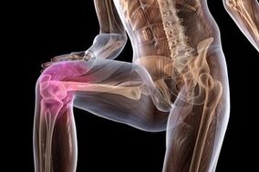 joint pain caused by knee joint