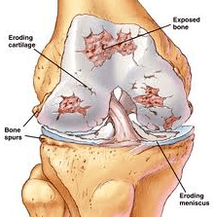 Mechanisms of joint development